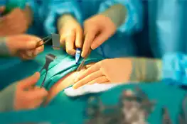 Varicose veins Treatment in Durg