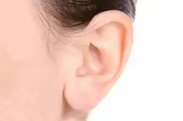 Varicose veins Treatment in Durg