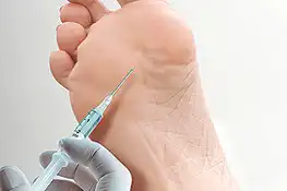Varicose veins Treatment in Durg