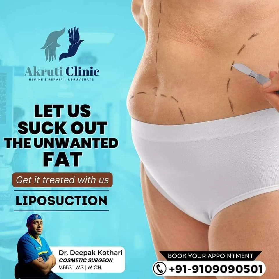 Fat Loss Surgery  in Chhattisgarh