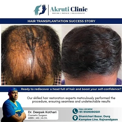 Akruti Clinic