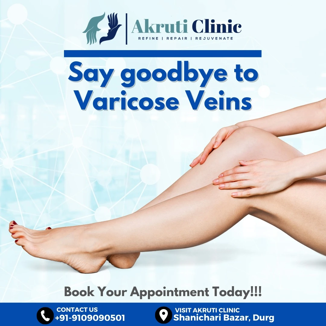 Varicose Veins Treatment in Chhattisgarh